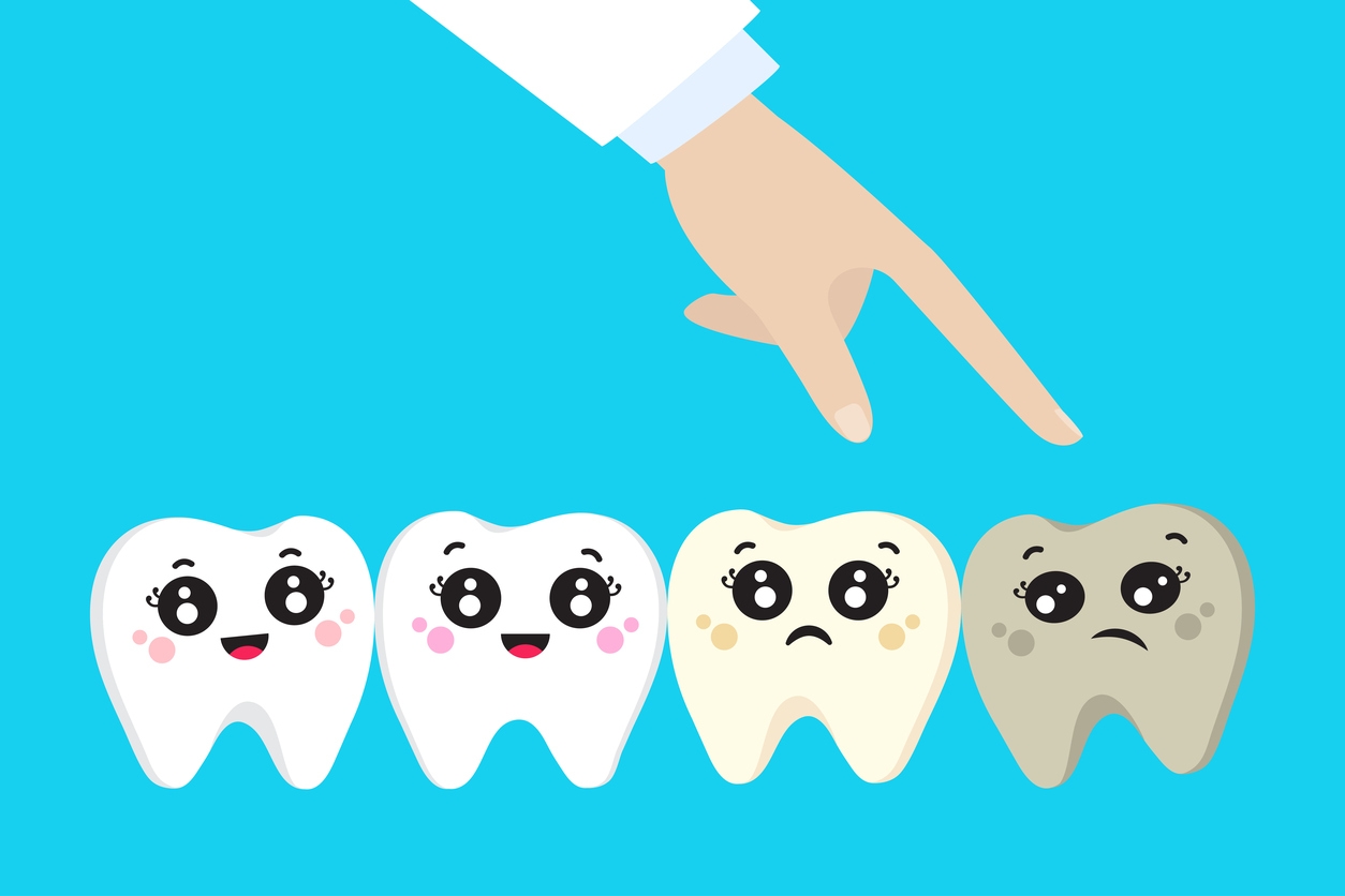 wisdom tooth extraction mississauga